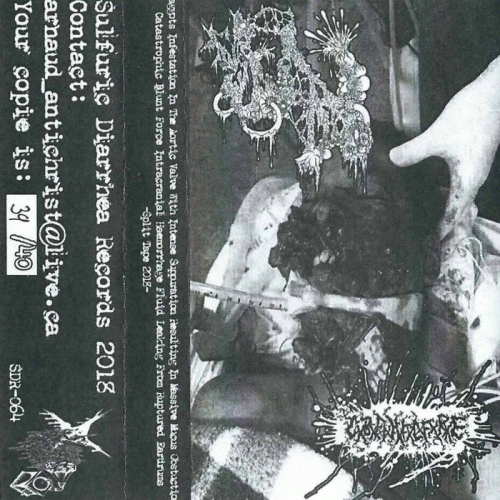 Catastrophic Blunt Force Intracranial Haemorrhage Fluid Leaking From Ruptured Eardrums : MxIxIxTxAxVxWxIxSxRxIxMxMxOx - CxBxFxIxHxFxLxFxRxE